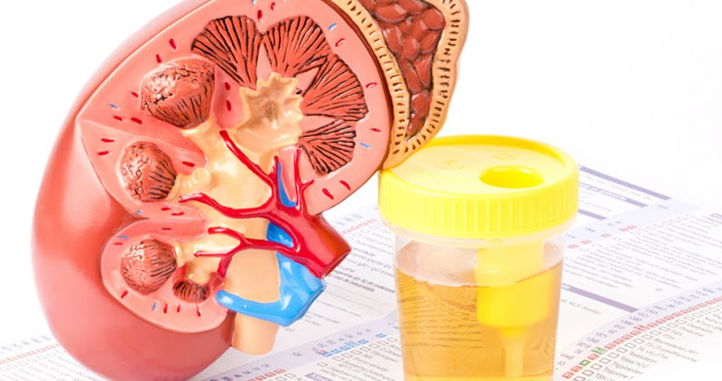 Overview of Kidney Function Tests