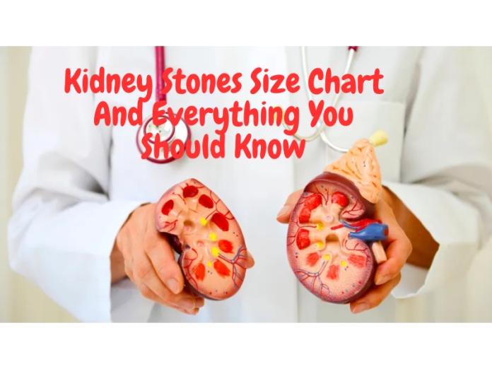 Kidney Stones Size Chart And Everything You Should Know