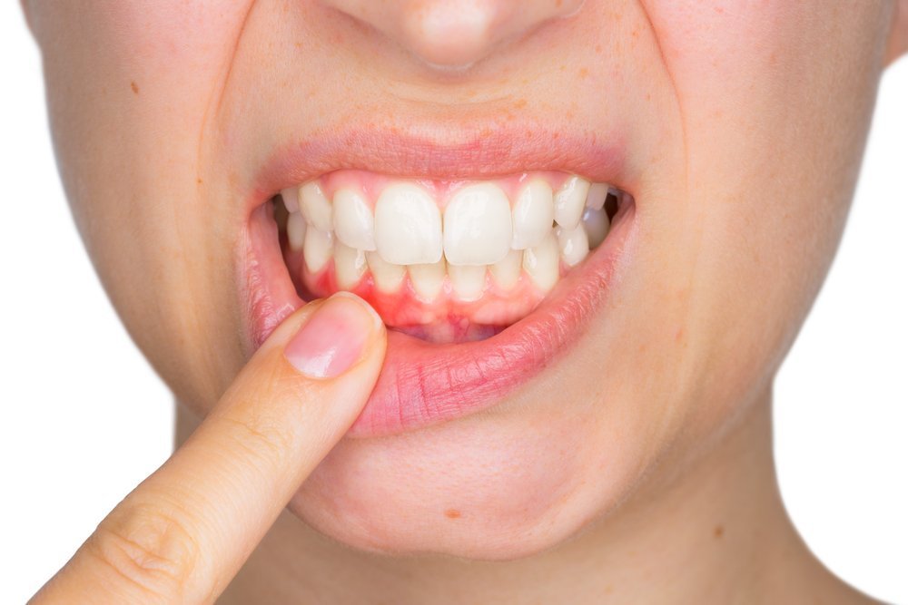 Tooth Infection: Everything You Need to Know