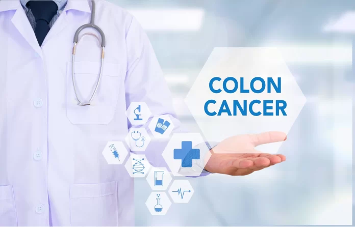 Colon Cancer Screening Understanding the Why, When, and How