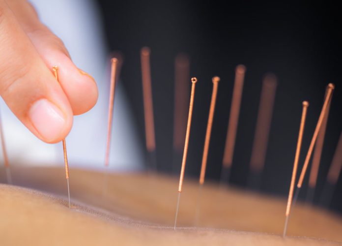 Unexpected Benefits of Acupuncture in Relieving Prostatitis
