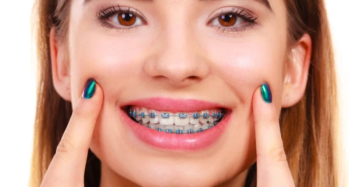 5 Tips To Help Teens Take Care Of Their Braces