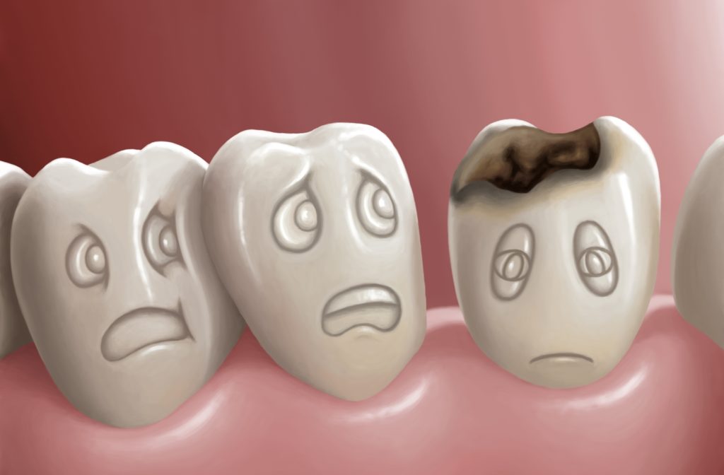 Breaking Down Tooth Abscesses: Symptoms and Solutions!