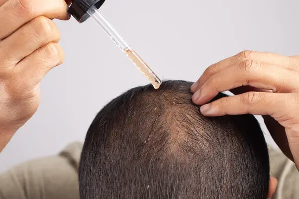How to Choose the Best Hair Growth Products