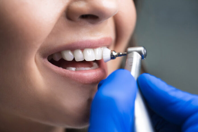 15 Must-Know Tips for First-Time Whittier Dental Patients