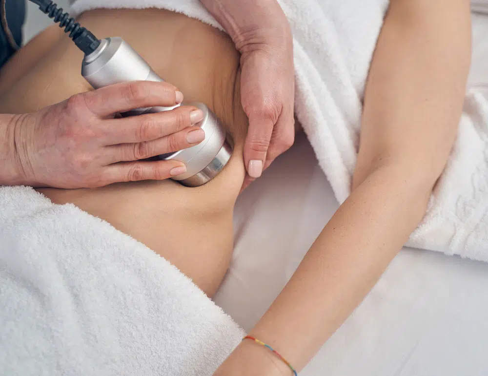 How Fat Cavitation is Changing the Weight Loss Game